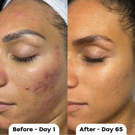 Vetra™ Silicone Scar Solutions Stick