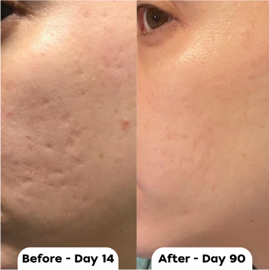 Vetra™ Silicone Scar Solutions Stick