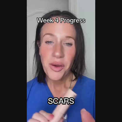 SCAR SOLUTIONS SILICONE SCAR STICK